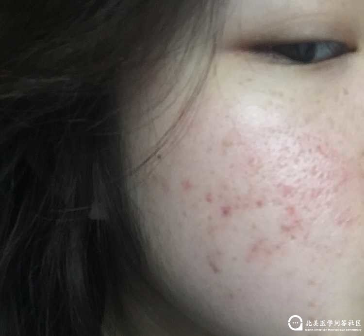 082111bangaideeawmimjd