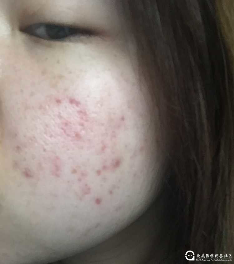 082110lq3zbqqunndqqbwb