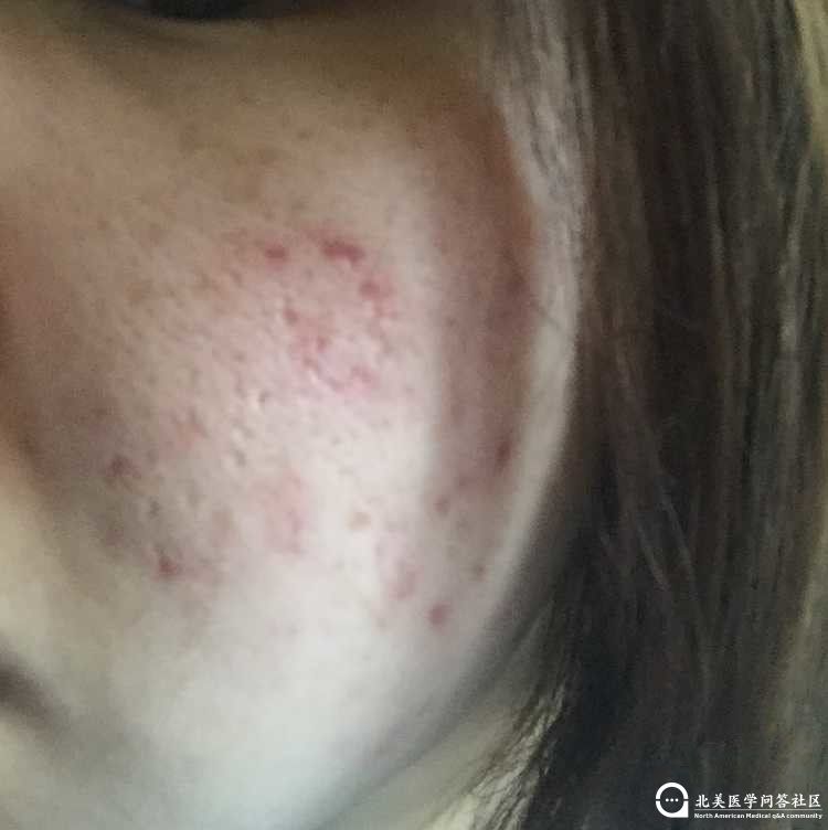 082110fk31ktkp3ke1sm11